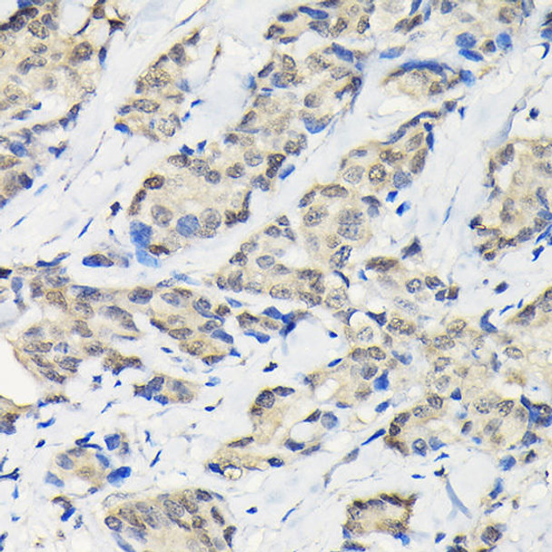 Cell Biology Antibodies 3 Anti-SSNA1 Antibody CAB13377