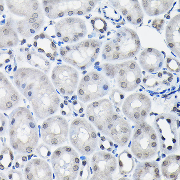 Cell Biology Antibodies 3 Anti-SSNA1 Antibody CAB13377