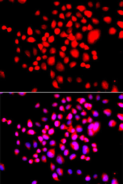 Cell Biology Antibodies 3 Anti-STK19 Antibody CAB13383