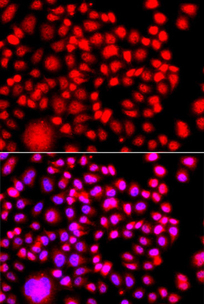 Cell Biology Antibodies 3 Anti-TESK2 Antibody CAB13395