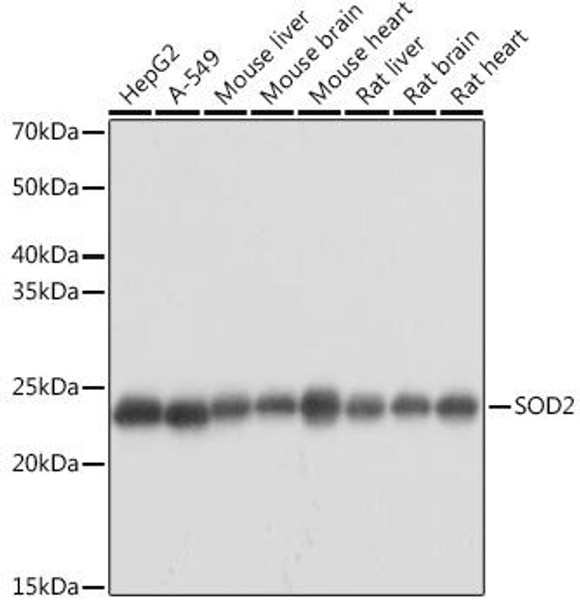 KO Validated Antibodies 1 Anti-SOD2 Antibody CAB1340KO Validated