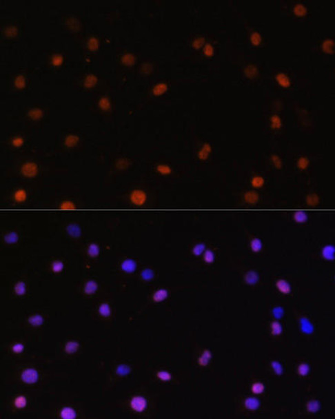 Cell Biology Antibodies 3 Anti-COPS5 Antibody CAB13401