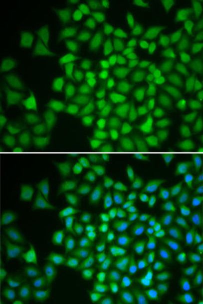 Cell Biology Antibodies 3 Anti-COPS5 Antibody CAB13401