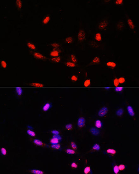 Cell Biology Antibodies 3 Anti-COPS5 Antibody CAB13401