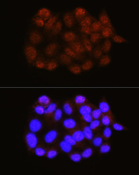 Autophagy Antibodies Anti-NRBF2 Antibody CAB13422