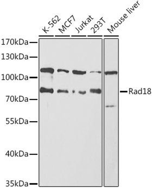 Epigenetics and Nuclear Signaling Antibodies 1 Anti-Rad18 Antibody CAB13434
