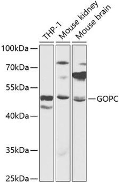 Cell Biology Antibodies 4 Anti-GOPC Antibody CAB13436