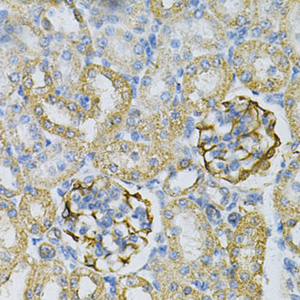 Cell Biology Antibodies 4 Anti-AK1 Antibody CAB13460