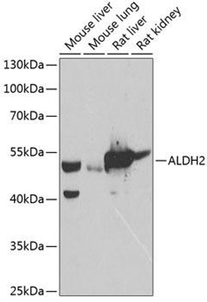 Cell Biology Antibodies 4 Anti-ALDH2 Antibody CAB13463