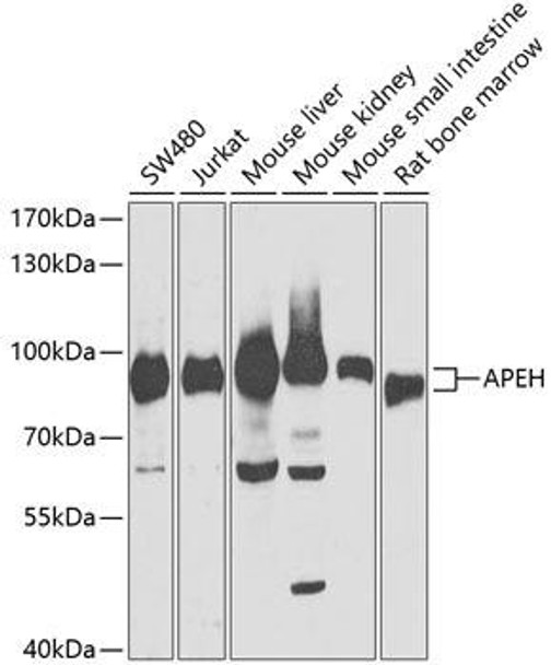 Cell Biology Antibodies 4 Anti-APEH Antibody CAB13467