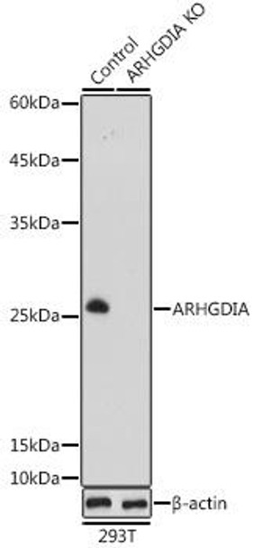 KO Validated Antibodies 1 Anti-ARHGDIA Antibody CAB13468KO Validated