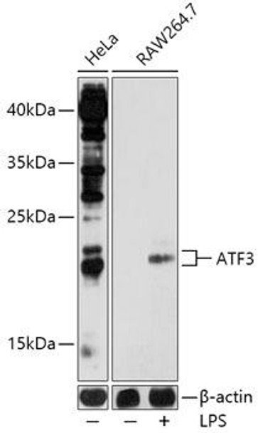 Epigenetics and Nuclear Signaling Antibodies 1 Anti-ATF3 Antibody CAB13470