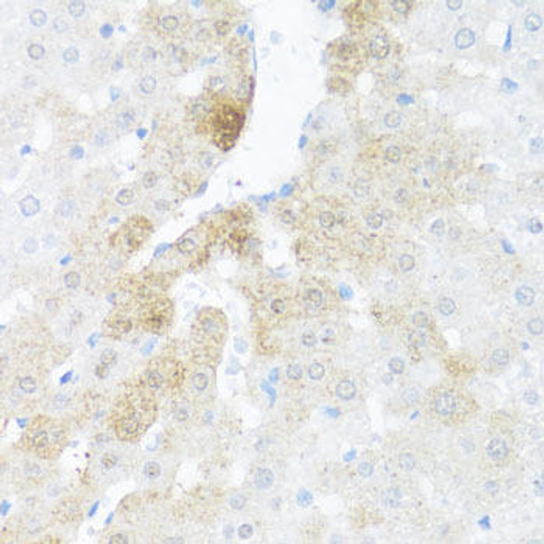 Cell Death Antibodies 1 Anti-Bcl-W Antibody CAB13471