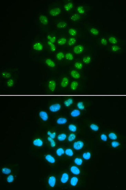 Epigenetics and Nuclear Signaling Antibodies 1 Anti-BMI1 Antibody CAB13472