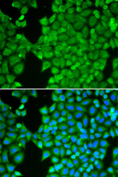 Cell Biology Antibodies 4 Anti-CA3 Antibody CAB13473