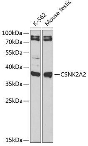 Cell Death Antibodies 1 Anti-CSNK2A2 Antibody CAB13481