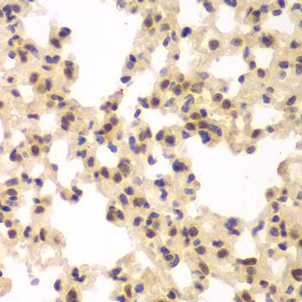 Cell Death Antibodies 1 Anti-CSNK2A2 Antibody CAB13481
