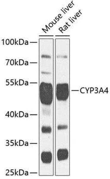KO Validated Antibodies 1 Anti-CYP3A4 Antibody CAB13484KO Validated