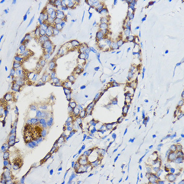 Metabolism Antibodies 1 Anti-CYP51A1 Antibody CAB13485