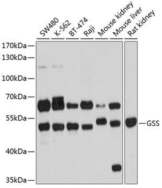 Metabolism Antibodies 1 Anti-GSS Antibody CAB13495
