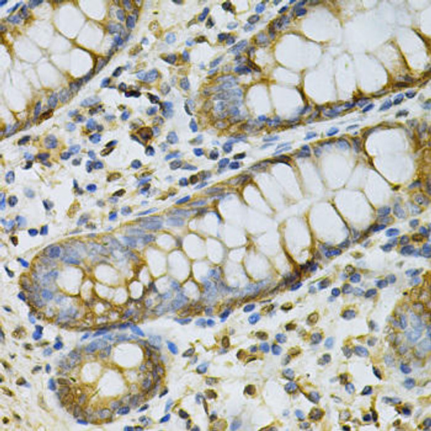 Cell Biology Antibodies 4 Anti-GSTM2 Antibody CAB13496