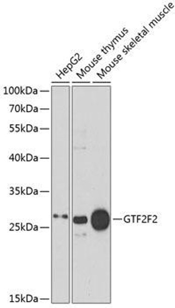 Epigenetics and Nuclear Signaling Antibodies 1 Anti-GTF2F2 Antibody CAB13497