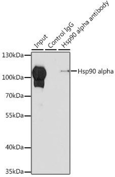 Immunology Antibodies 1 Anti-Hsp90 alpha Antibody CAB13501