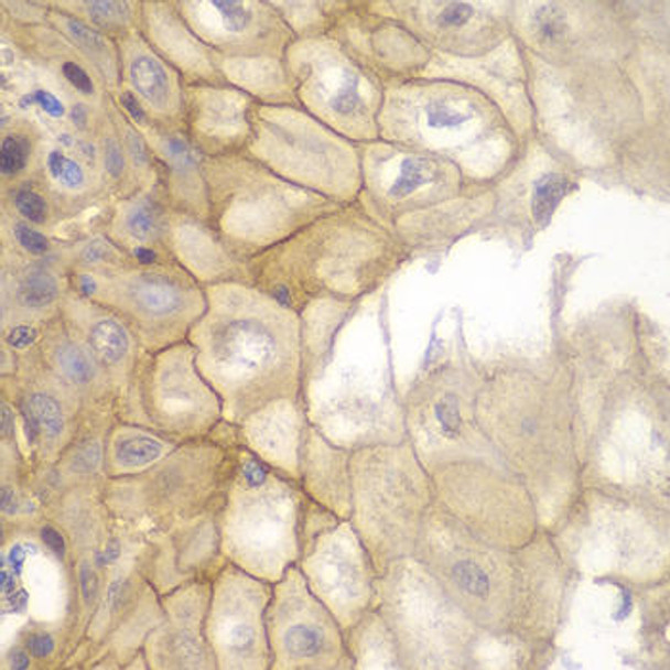 Cell Biology Antibodies 4 Anti-CD127/IL-7R Antibody CAB13503