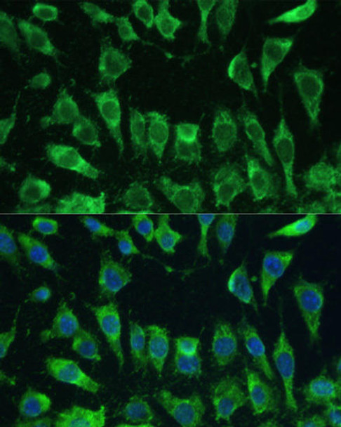 KO Validated Antibodies 1 Anti-LGALS3 Antibody CAB13506KO Validated