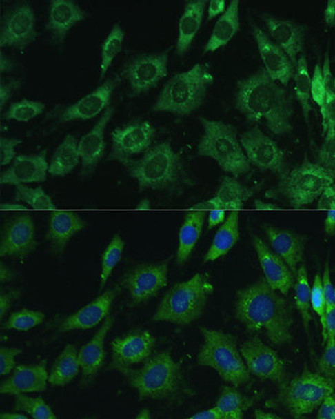 KO Validated Antibodies 1 Anti-LGALS3 Antibody CAB13506KO Validated