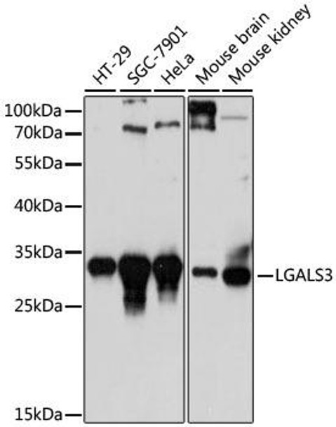 KO Validated Antibodies 1 Anti-LGALS3 Antibody CAB13506KO Validated