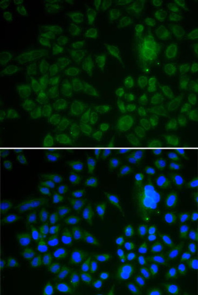 Cell Biology Antibodies 4 Anti-LRP1 Antibody CAB13509