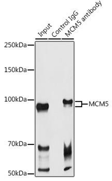 Cell Cycle Antibodies 1 Anti-MCM5 Antibody CAB13514