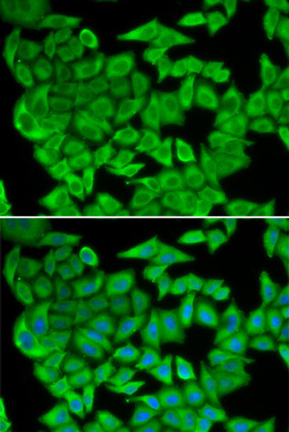 Metabolism Antibodies 1 Anti-MDH2 Antibody CAB13516