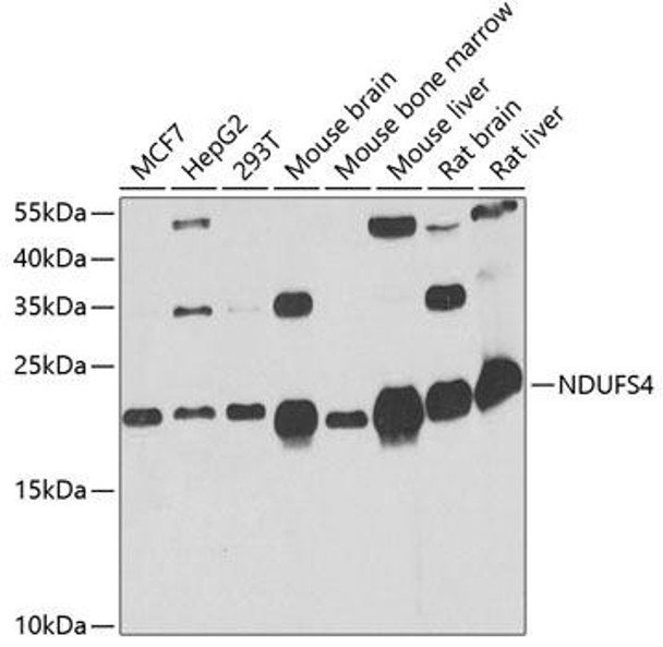 Cell Biology Antibodies 4 Anti-NDUFS4 Antibody CAB13519