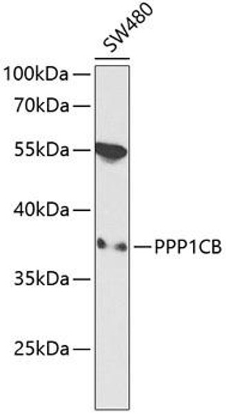 Cell Biology Antibodies 4 Anti-PPP1CB Antibody CAB13529
