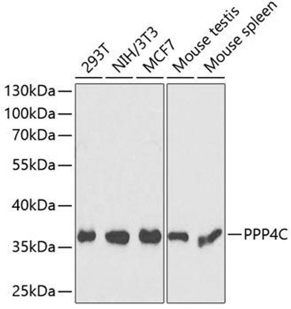 Cell Biology Antibodies 4 Anti-PPP4C Antibody CAB13531
