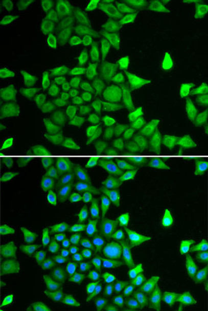 Cell Biology Antibodies 4 Anti-PSMA6 Antibody CAB13536