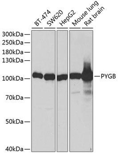 Metabolism Antibodies 1 Anti-PYGB Antibody CAB13539