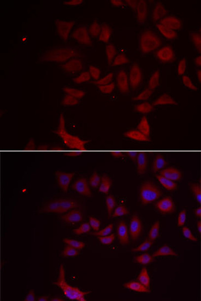 Cell Biology Antibodies 4 Anti-RPL11 Antibody CAB13542