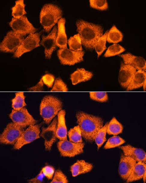 Cell Death Antibodies 1 Anti-RPS3 Antibody CAB13543