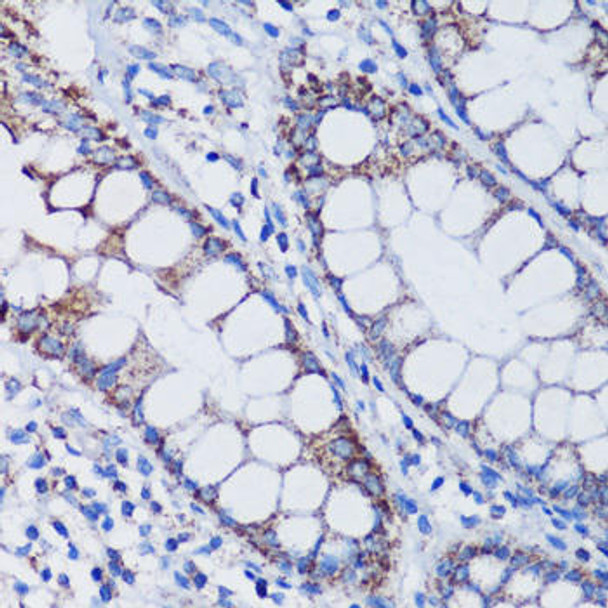 Epigenetics and Nuclear Signaling Antibodies 1 Anti-TFAM Antibody CAB13552