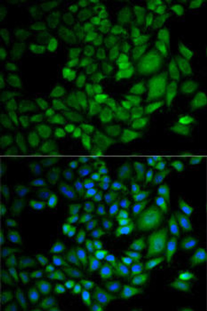 Cell Biology Antibodies 4 Anti-AKR1C3 Antibody CAB13568