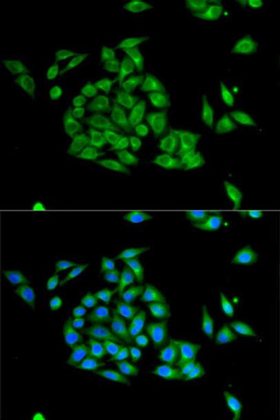 Cell Biology Antibodies 4 Anti-PICK1 Antibody CAB13574