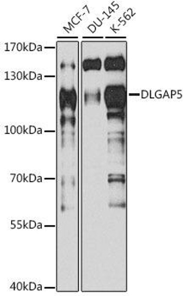 Cell Cycle Antibodies 1 Anti-DLGAP5 Antibody CAB13575