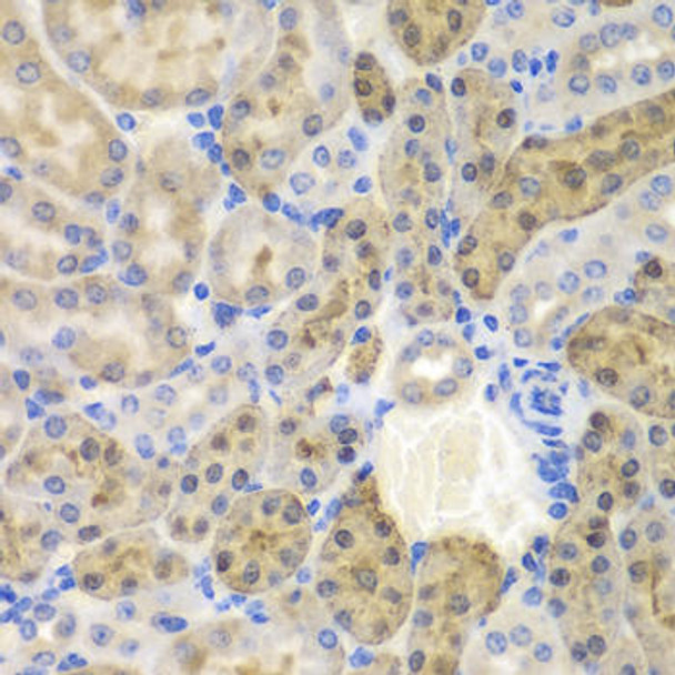 Cell Biology Antibodies 4 Anti-AKR1A1 Antibody CAB13577