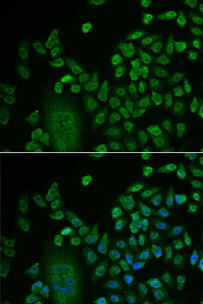 Epigenetics and Nuclear Signaling Antibodies 1 Anti-LSM4 Antibody CAB13588