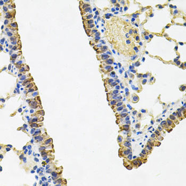 Cell Biology Antibodies 4 Anti-ACSS2 Antibody CAB13596