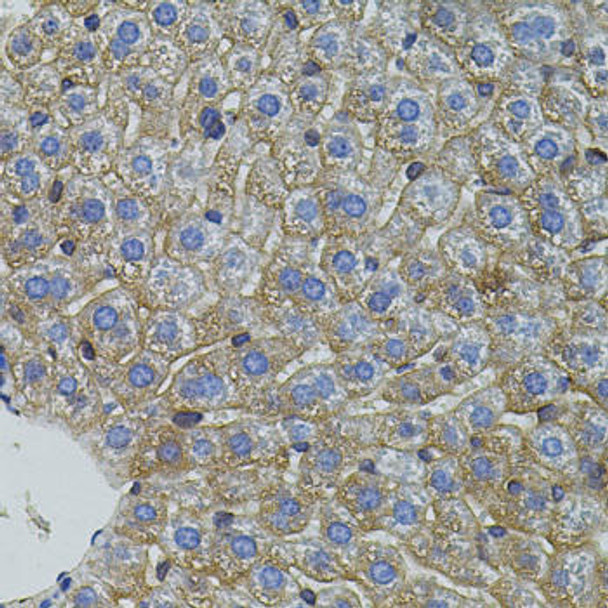 Cell Biology Antibodies 16 Anti-Mitofusin 2 Antibody CAB13606