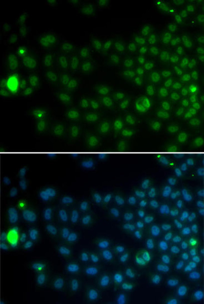 Cell Cycle Antibodies 1 Anti-SPDYA Antibody CAB13607